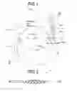Fig. 02 - Intraocular lens