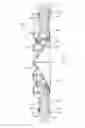 Fig. 01 - Devices and methods for retrievable intra-atrial implants