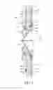 Fig. 05 - Devices and methods for retrievable intra-atrial implants