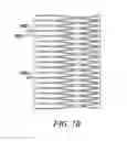 Fig. 08 - Devices and methods for retrievable intra-atrial implants