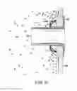 Fig. 31 - Devices and methods for retrievable intra-atrial implants
