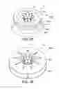 Fig. 34 - Devices and methods for retrievable intra-atrial implants