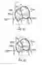 Fig. 49 - Devices and methods for retrievable intra-atrial implants