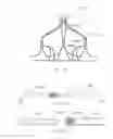 Fig. 58 - Devices and methods for retrievable intra-atrial implants