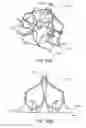 Fig. 68 - Devices and methods for retrievable intra-atrial implants