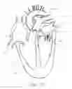 Fig. 13 - Cardiac valve repair device