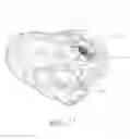 Fig. 14 - Cardiac valve repair device