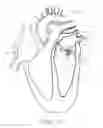 Fig. 15 - Cardiac valve repair device