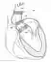 Fig. 01 - System and method for treating valve insufficiency or vessel dilatation