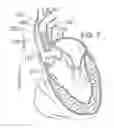 Fig. 04 - System and method for treating valve insufficiency or vessel dilatation