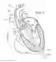 Fig. 06 - System and method for treating valve insufficiency or vessel dilatation