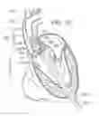 Fig. 07 - System and method for treating valve insufficiency or vessel dilatation