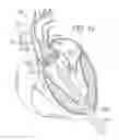 Fig. 09 - System and method for treating valve insufficiency or vessel dilatation