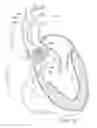 Fig. 13 - System and method for treating valve insufficiency or vessel dilatation