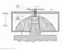 Fig. 01 - Removable head assembly for artificial joint