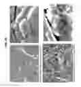 Fig. 32 - Decreasing bacterial responses on nano-modified titanium
