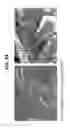 Fig. 34 - Decreasing bacterial responses on nano-modified titanium