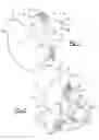 Fig. 02 - PATIENT-SPECIFIC GLENOID IMPLANT