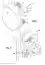 Fig. 05 - PATIENT-SPECIFIC GLENOID IMPLANT