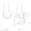 Fig. 04 - Femoral slideway and method