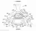 Fig. 01 - Expandable intervertebral spacer and method of posterior insertion thereof