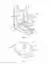Fig. 02 - Disc prosthesis