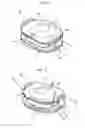 Fig. 02 - Intervertebral Disc Prosthesis and Instrumentation for Insertion of the Prosthesis between the Vertebrae