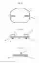 Fig. 05 - Intervertebral Disc Prosthesis and Instrumentation for Insertion of the Prosthesis between the Vertebrae