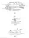 Fig. 04 - Transforaminal prosthetic spinal disc apparatus