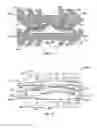Fig. 09 - Transforaminal prosthetic spinal disc apparatus