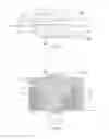 Fig. 13 - Transforaminal prosthetic spinal disc apparatus