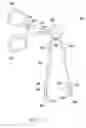Fig. 10 - Interlaminar fixation device