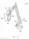 Fig. 37 - Interlaminar fixation device