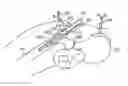 Fig. 01 - Systems and methods for facilitating hip surgery