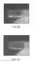 Fig. 03 - Biodegradable endoprostheses and methods of their fabrication