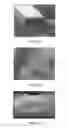Fig. 10 - Biodegradable endoprostheses and methods of their fabrication