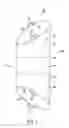 Fig. 07 - Gastric restriction devices for treating obesity