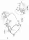 Fig. 16 - Gastric restriction devices for treating obesity