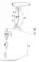 Fig. 18 - Gastric restriction devices for treating obesity