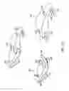 Fig. 20 - Gastric restriction devices for treating obesity