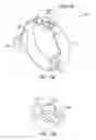 Fig. 21 - Gastric restriction devices for treating obesity