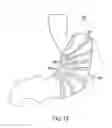 Fig. 27 - Gastric restriction devices for treating obesity