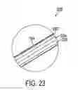Fig. 32 - Gastric restriction devices for treating obesity