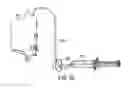 Fig. 35 - Gastric restriction devices for treating obesity