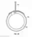 Fig. 38 - Gastric restriction devices for treating obesity