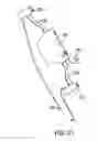 Fig. 40 - Gastric restriction devices for treating obesity