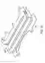 Fig. 41 - Gastric restriction devices for treating obesity