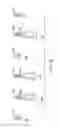 Fig. 42 - Gastric restriction devices for treating obesity