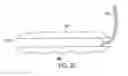 Fig. 45 - Gastric restriction devices for treating obesity