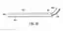 Fig. 48 - Gastric restriction devices for treating obesity